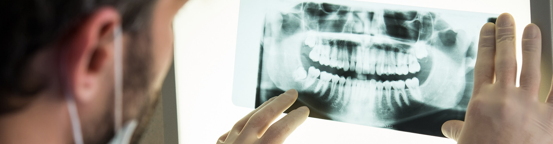 Root Canal Therapy, Marietta