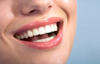 Marietta GA Teeth Bleaching Treatment