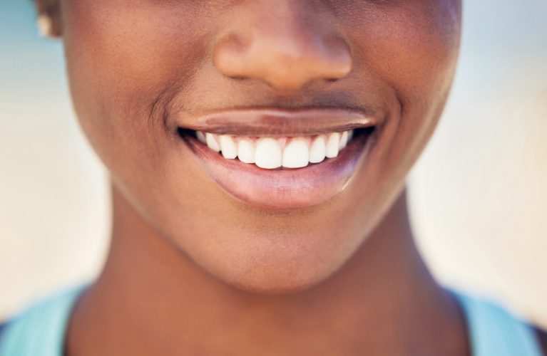 Closeup, mouth and woman with smile, teeth whitening and oral hygiene treatment with wellness. Person, outdoor or dental care with gum cleaning, veneers or orthodontics satisfaction with fresh breath